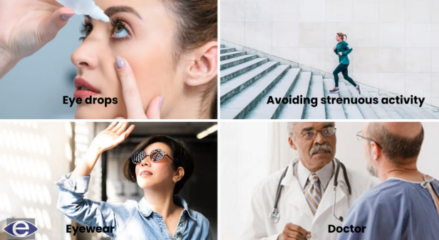 contoura-lasik-treatment-aftercare-instructions-for-contoura-lasik