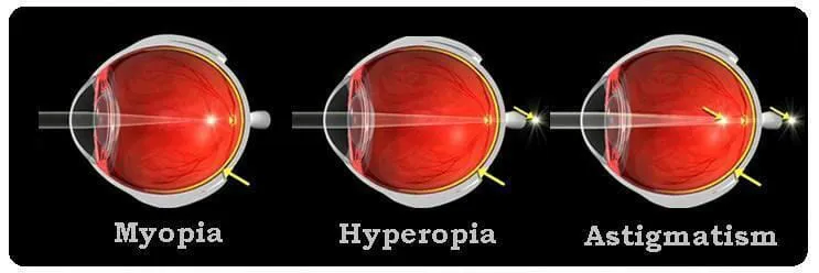 types-of-eye-sight